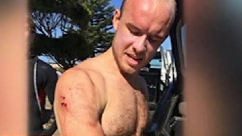 Australija: Ljekar se odbranio od ajkule, udario je pesnicom