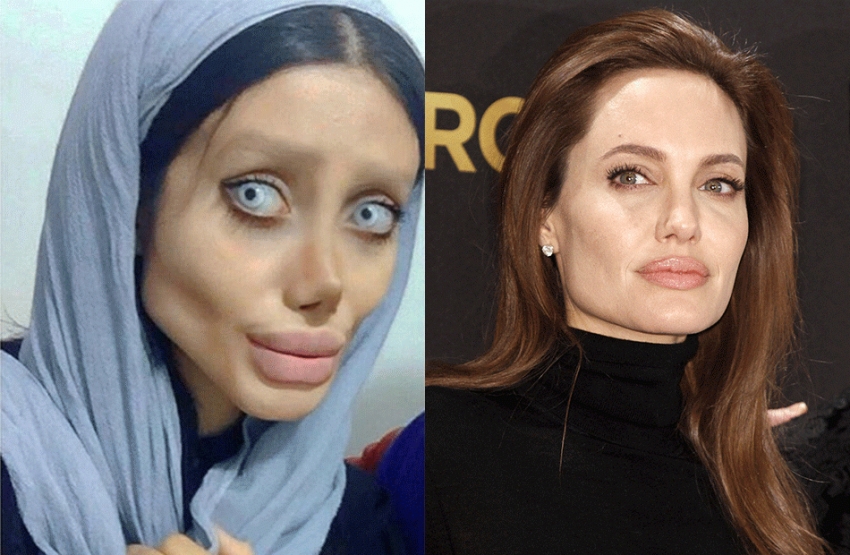 Bizarno: Iranka koja se uništila plastičnim intervencijama da bi ličila na Anđelinu Džoli!