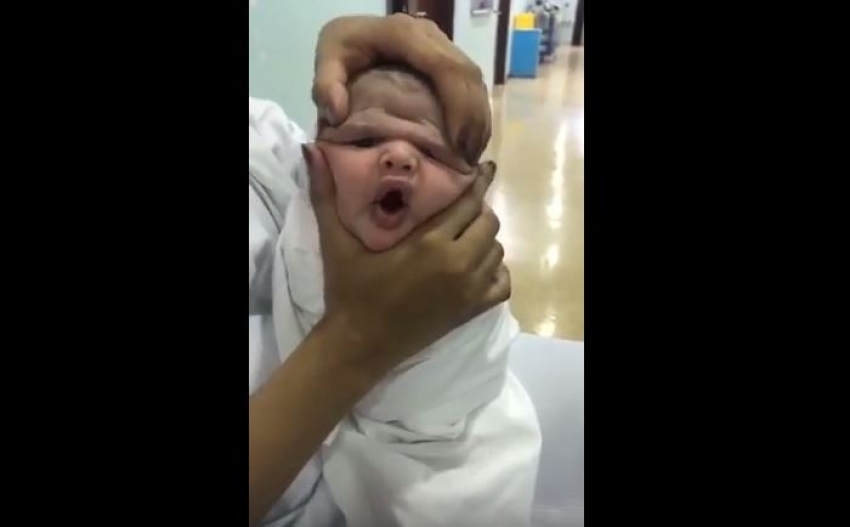 VIDEO – Još se i smiju: Medicinske sestre stiskale bebi glavu