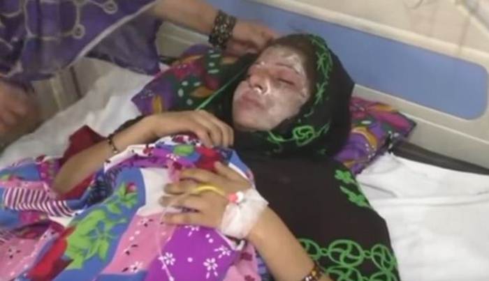 Rodila drugu ćerku, a muž je polio kisjelinom jer je želio sina