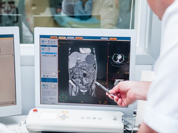 Istraživanje: Kompjuter bolji od dermatologa u uočavanju raka kože