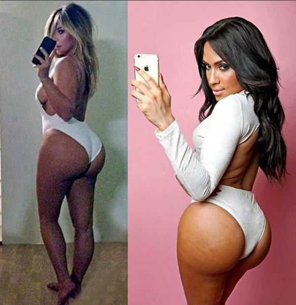 Bila je muškarac, a danas ima ZADNJICU kao Kim Kardašijan
