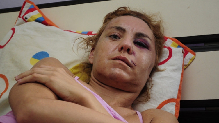 Vezao me kablom od fena i počeo pesnicama udarati u glavu: Stravična priča pretučene djevojke u Srbiji