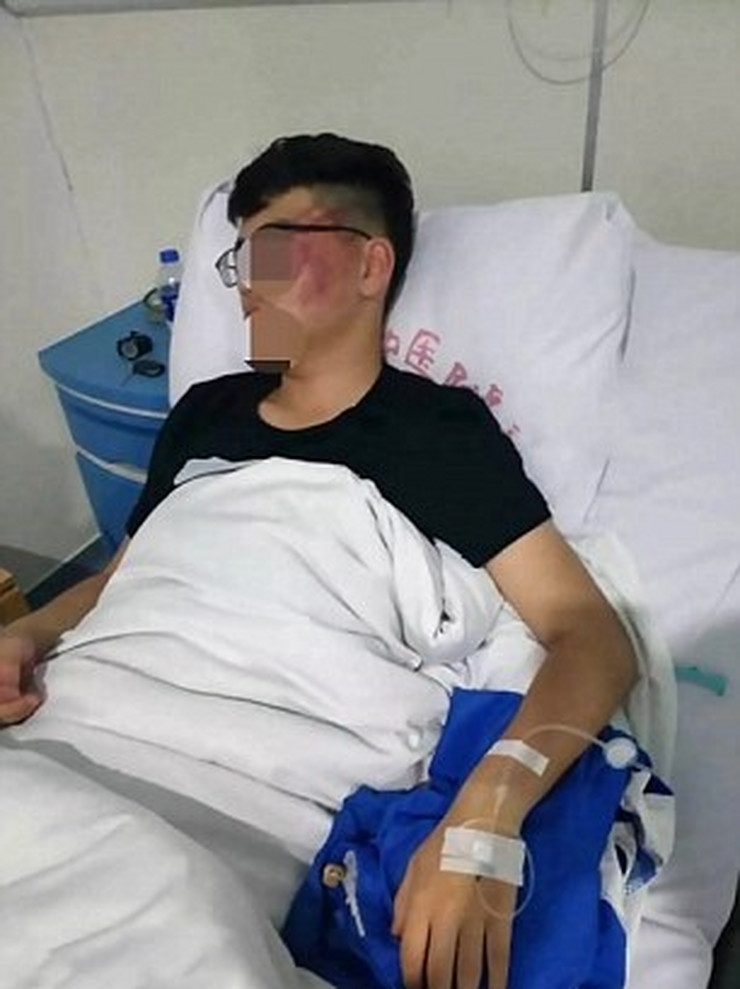 FOTO – Učenik završio u bolnici sa potresom mozga: Pričao sa drugom pa mu profesor opalio 12 šamara