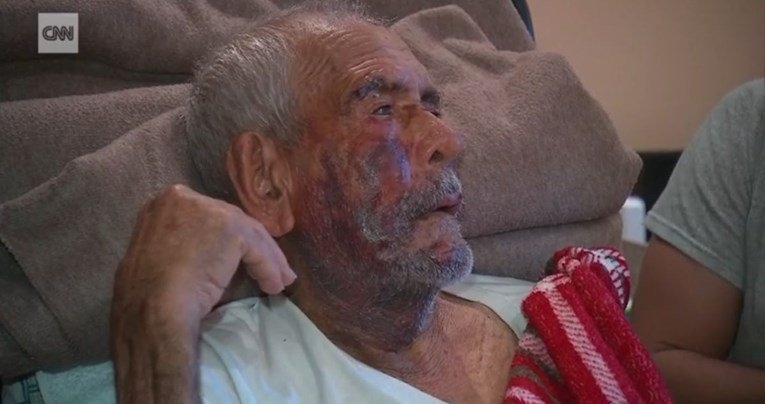 “Vrati se u Meksiko!”: Amerikanka ciglom pretukla 91-godišnjeg starca, pomoglo joj i nekoliko muškaraca