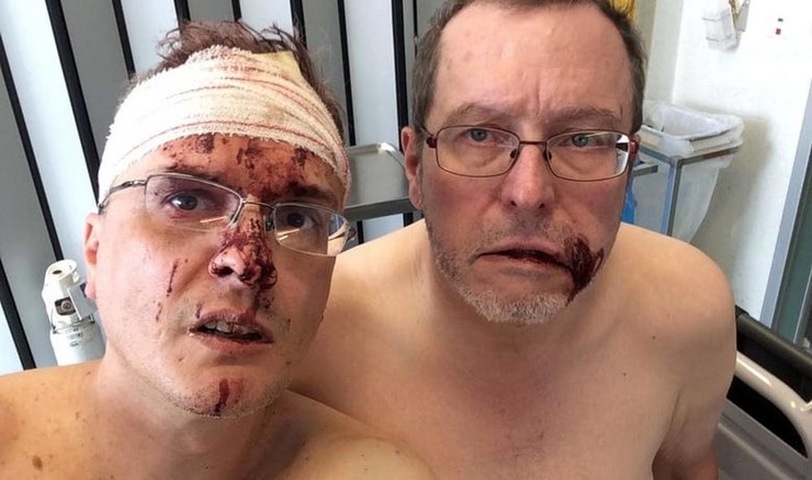 Hrvatica i Bugarin brutalno pretukli gej par u Belgiji: “Dočekali su nas na parkingu i premlatili metalnom polugom”