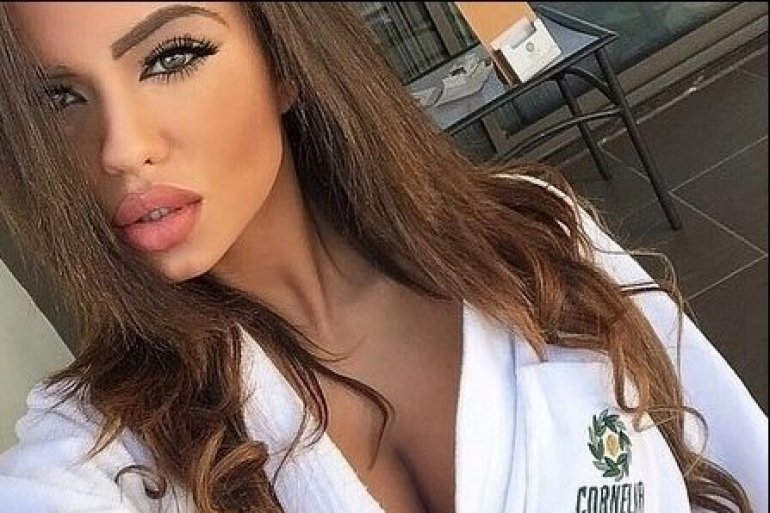 VIDEO – OVO je bogata misica iz Španije koja je povrijeđena u eksploziji u Zemunu