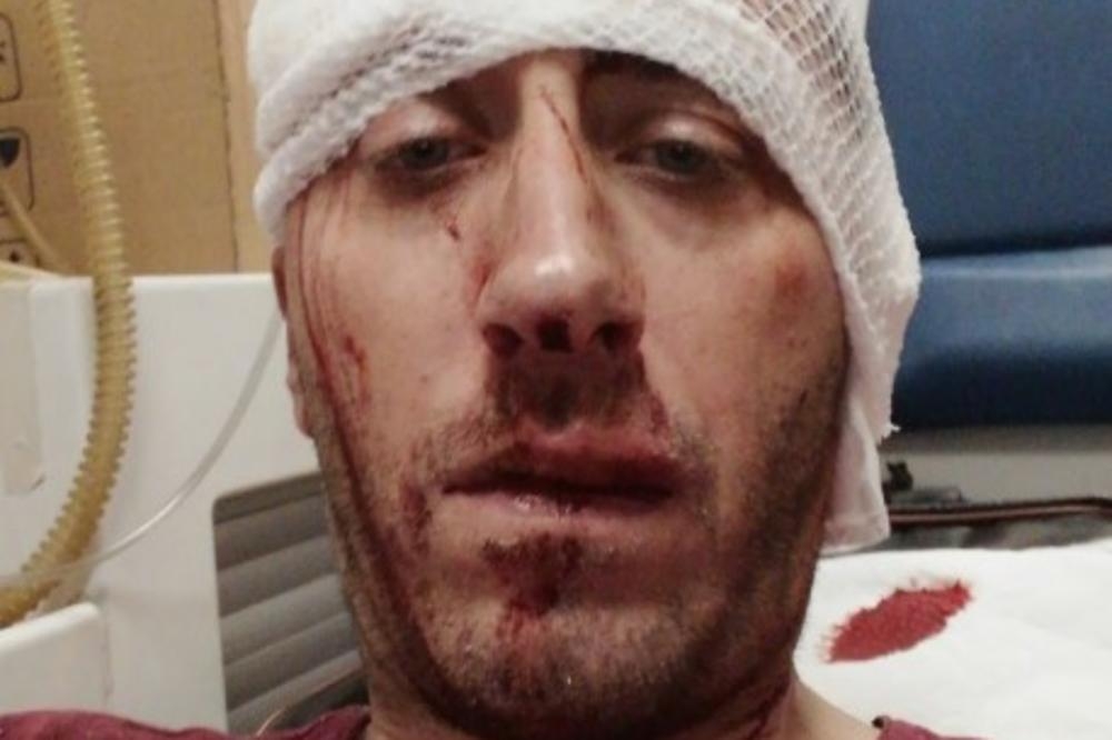 Brutalno pretučen novinar BN TV Vladimir Kovačević