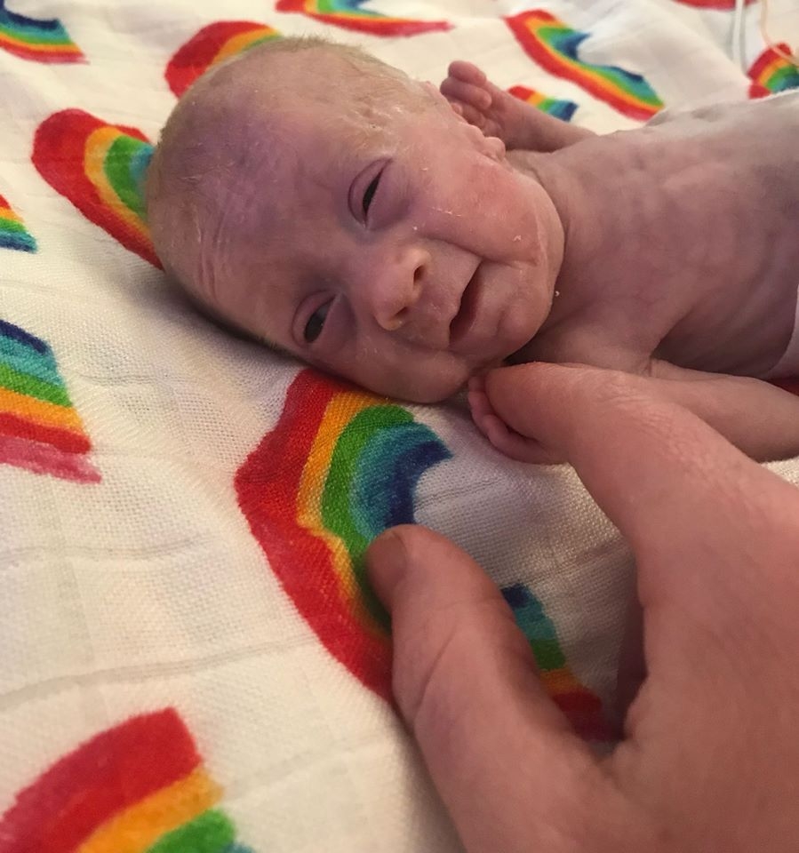 VIDEO: Doktori BEBI od 370 grama nisu davali NIKAKVE ŠANSE, ali je ona SVE IZNENADILA