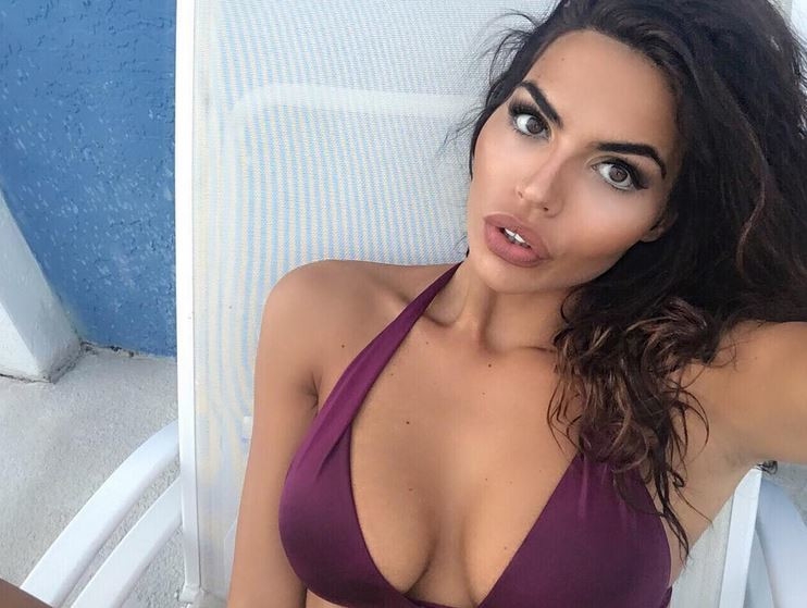 Dejana progovorila o udesu zbog kojeg joj se lice IZDEFORMISALO