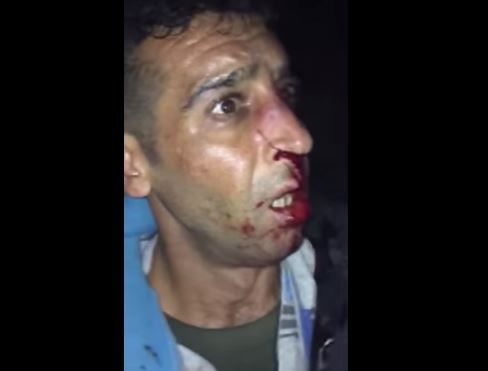 “Hrvatska policija im lomi kosti…”: Guardian objavio uznemirujući snimak pretučenih migranata