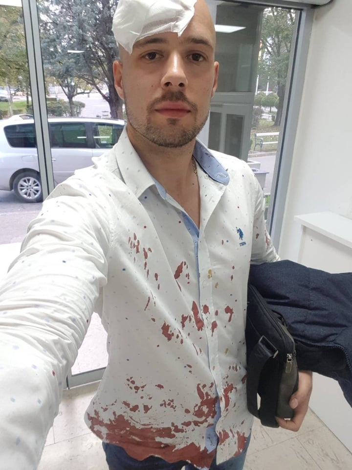 FOTO: Rajo Simonović nakon saobraćajne nezgode za Standard: Krv se slivala niz moju glavu, ali sam bio priseban!