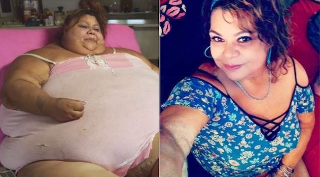 Zbog 270 kilograma, 12 godina nije ustala iz kreveta, suprug ju je VARAO, a onda…