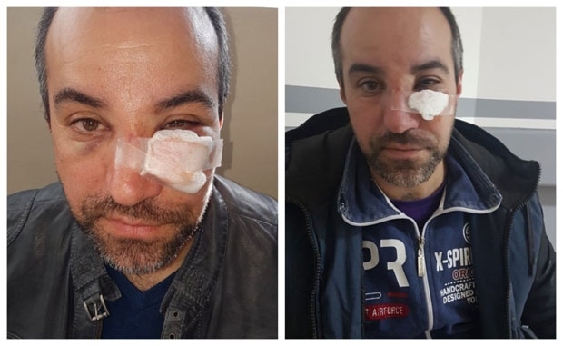 Tomkić: Ne osjećam se bezbjedno jer su nalogodavci na slobodi