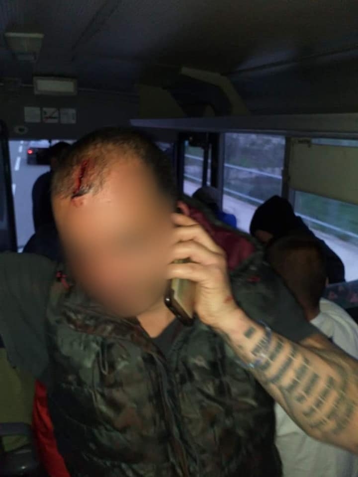 FOTO Varvari: Povrijeđeno mnogo navijača, policija upotrebila prekomjernu silu