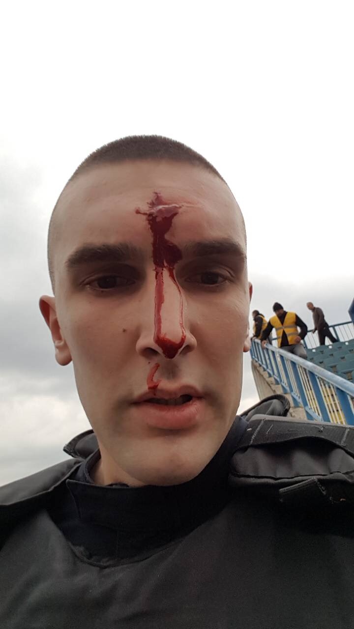 Uznemirujuće: “Varvari” napali policiju nakon utakmice u Nikšiću, povrijeđeno šest policajca