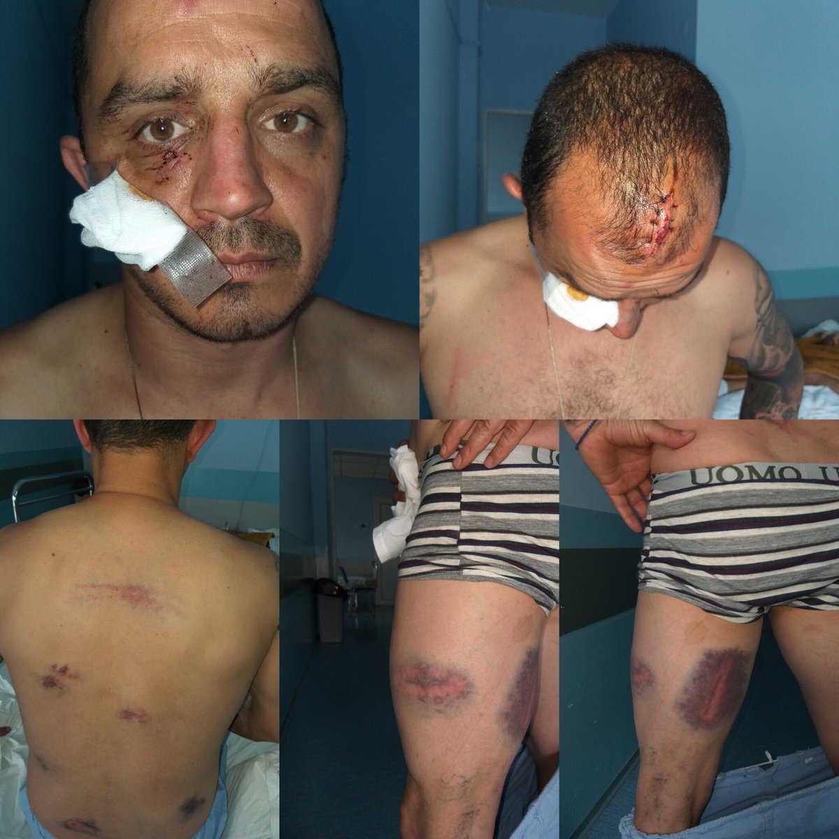 Čaka ne zna koji policajac ga je udario u glavu