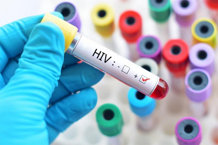 Drugi slučaj izlječenja od infekcije virusom HIV