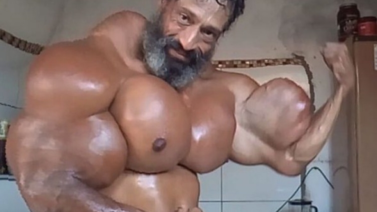 Ima najveći biceps na svijetu, ono što ubrizgava u sebe može ga odmah ubiti!