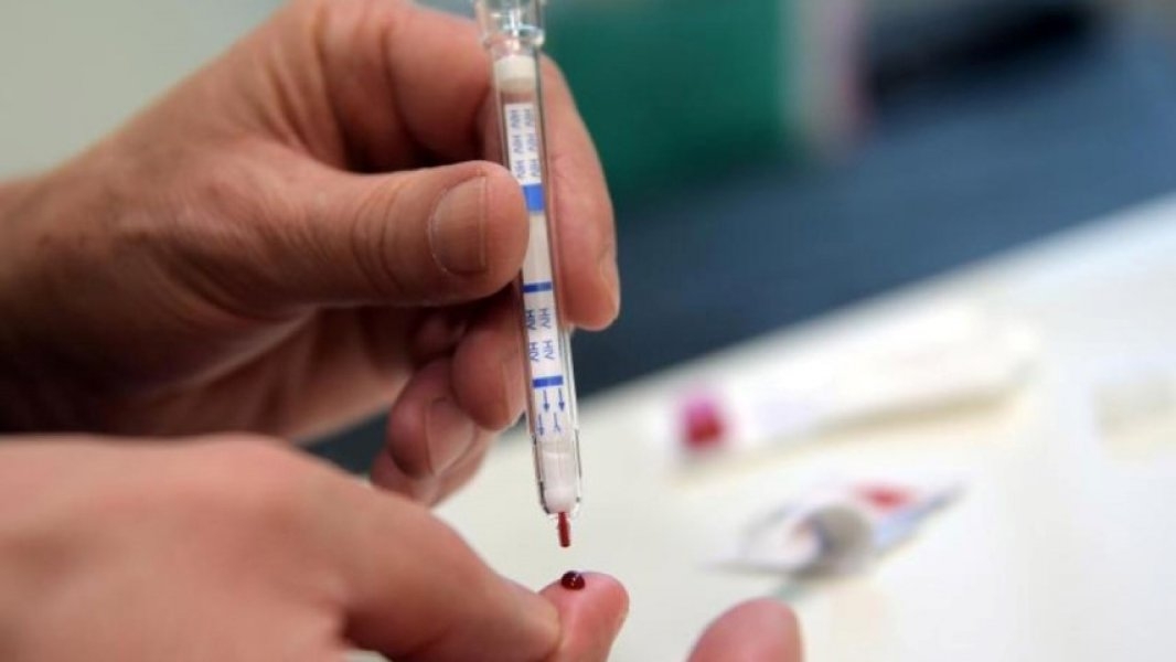 Veliko otkriće: Kraj AIDS-a na vidiku