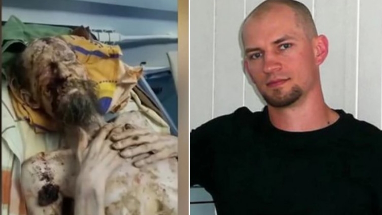 “Živa mumija” koju je navodno napao medvjed ovako izgleda i evo šta mu se zapravo dogodilo