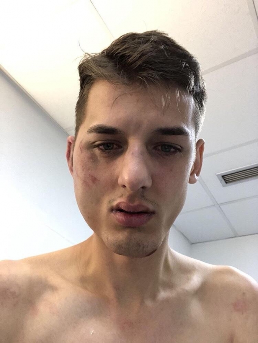 Uprava policije: Sekulović imao 1,84 promila alkohola u krvi, batine dobio od nekog drugog