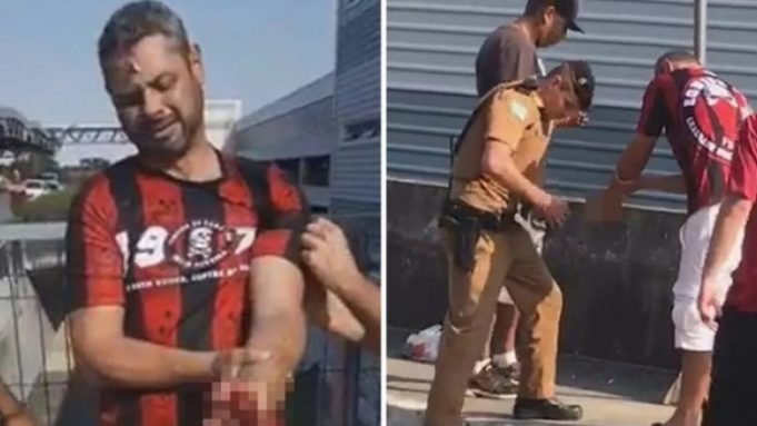 Zastrašujući video: Topovski udar mu eksplodirao u ruci, posljedice su fatalne
