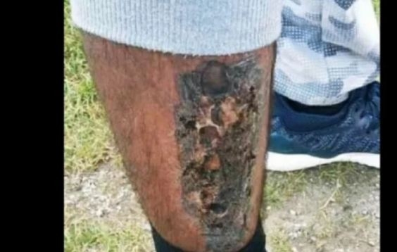 Šok u Hrvatskoj, migranti optužuju: Policija nas je žigosala!