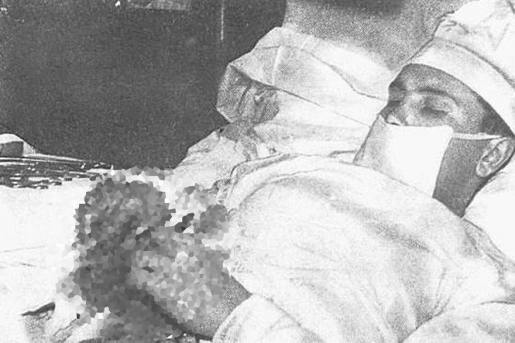 Nevjerovatna priča: Ruski hirurg koji je sam sebe operisao