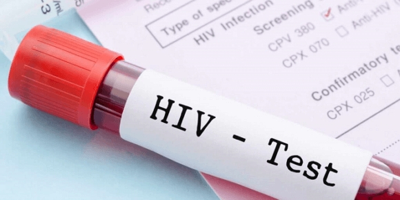 Besplatno testiranje na HIV i hepatitise od 22. do 30. novembra