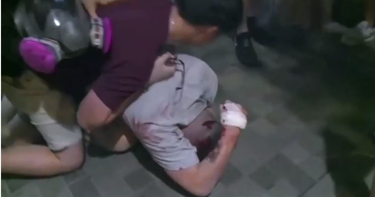 Haos na protestima u Hong Kongu: Muškarac odgrizao uvo političaru!
