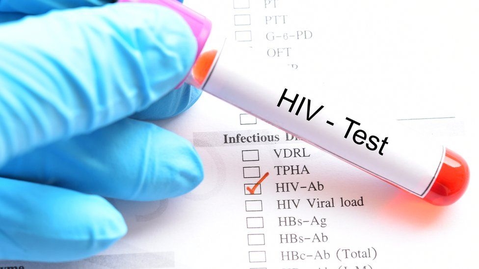 HIV-om zaraženo 400 građana