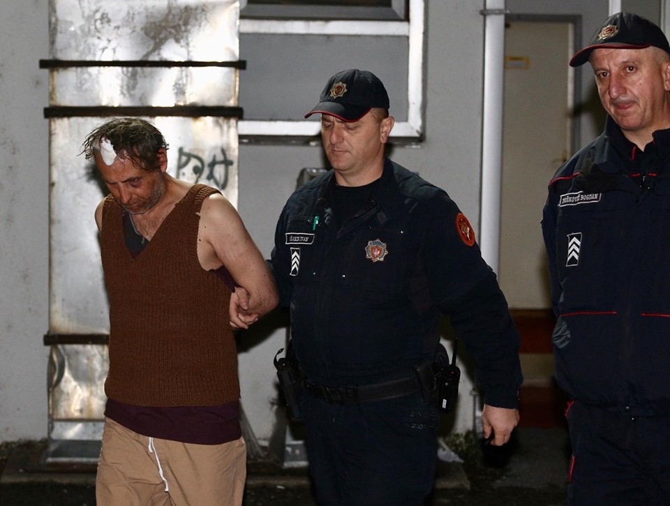 FOTO: Povrede po licu nastale nakon napada na policajce iz drugog vozila: Pravo čudo da u pucnjavi nije bilo još žrtava