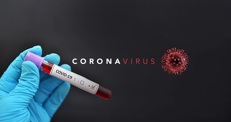 Hrvatska: Testiranje cijele populaciju na korona virus