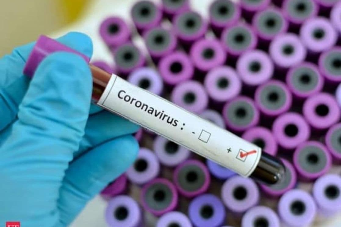 U regionu danas jedna žrtva korona virusa, evo koliko je zaraženih