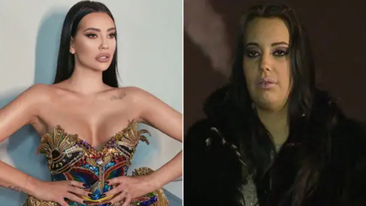 Katarina je sada seks bomba, a prije brojnih operacija izgledala je OVAKO