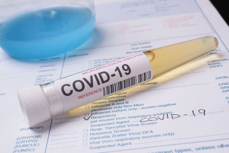 Epidemija: Otkriveno još 17 slučajeva infekcije koronavirusom, od toga 9 iz Podgorice