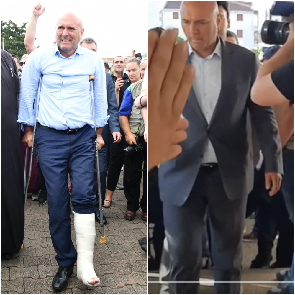 MEDICINSKI FENOMEN: Careviću za jednu noć ozdravila noga, skinuo gips i brzim hodom došao do posla