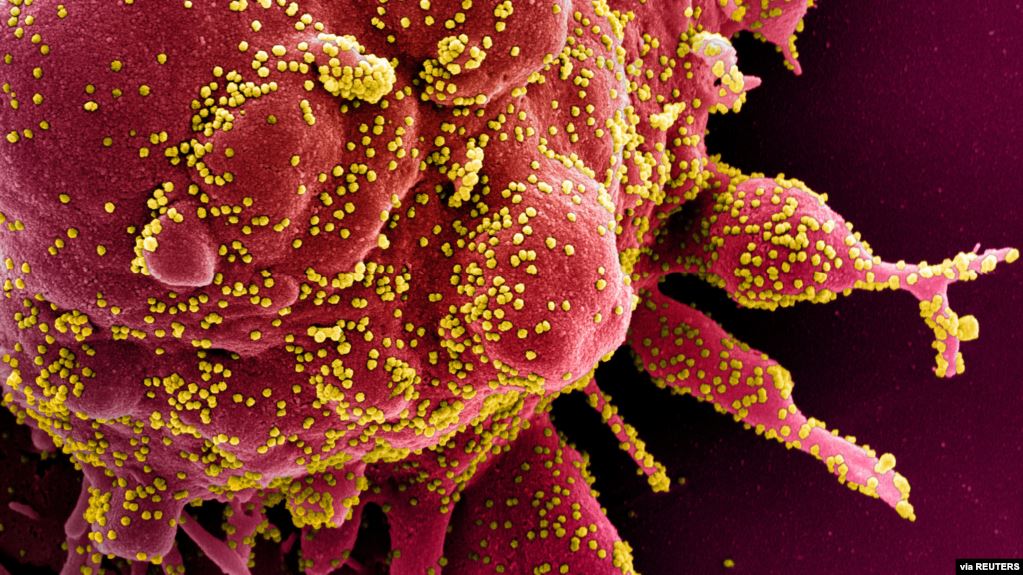 Stotine naučnika tvrdi da se koronavirus prenosi vazduhom, SZO da promijeni preporuke
