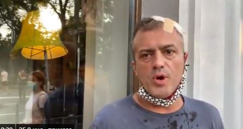 Trifunović nakon napada: Napali me pripadnici Levijatana, u gužvi neko krenuo da me udara sa svih strana