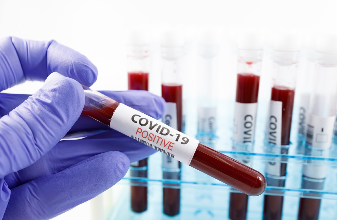 Još 66 novopozitivnih na koronavirus, preminule 3 osobe