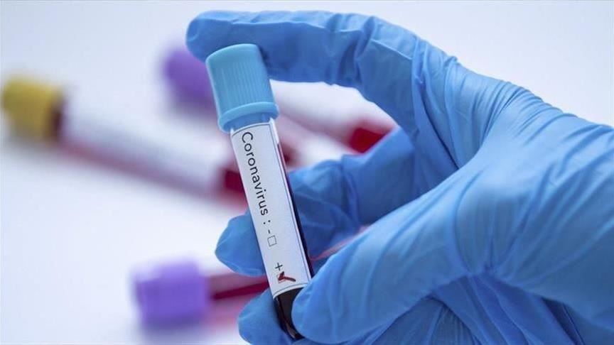 Koronavirus odnio najmanje 843.149 života, 25 miliona zaraženih