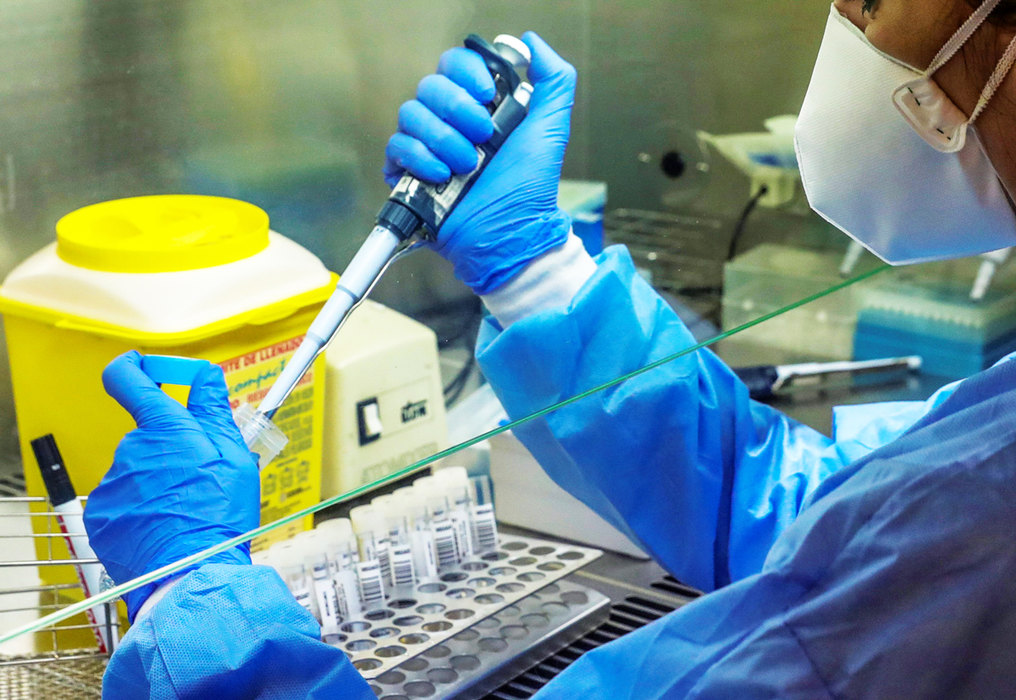 Ugovorena nabavka 93.333 brza testa na koronavirus