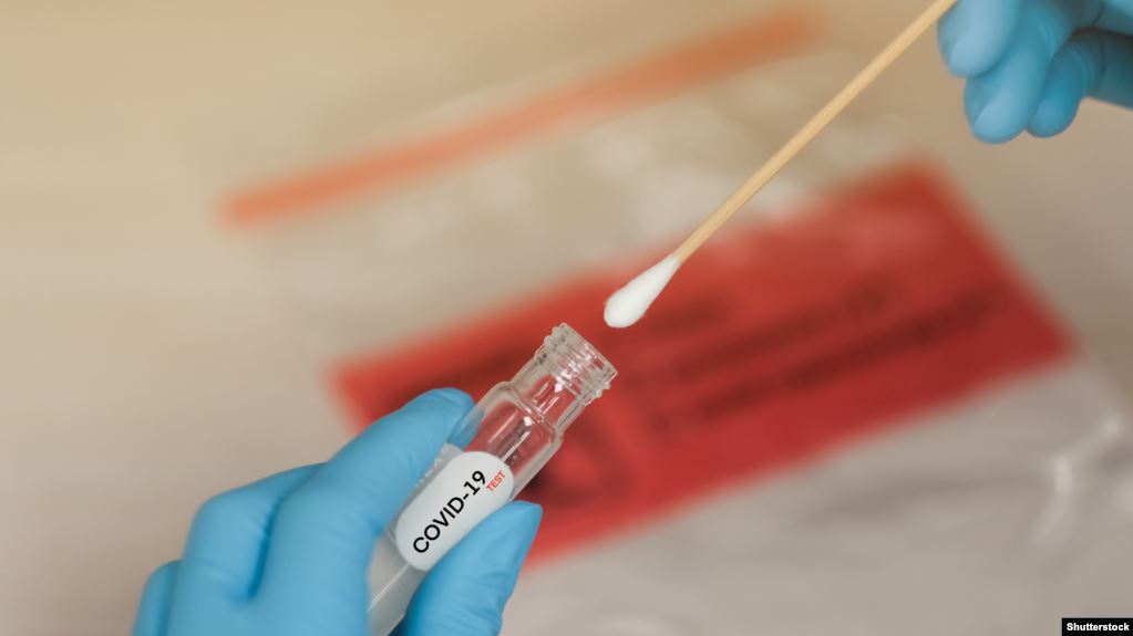 Još 226 novopozitivnih na koronavirus, najviše iz Nikšića