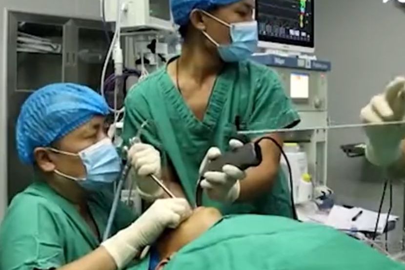 Pijavica živjela u nosu petogodišnjeg dječaka duže od godinu dana