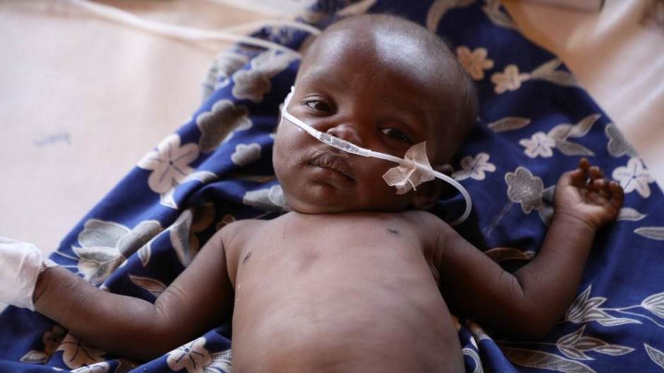 Od upale pluća godišnje u Nigeriji umire više od 140.000 djece