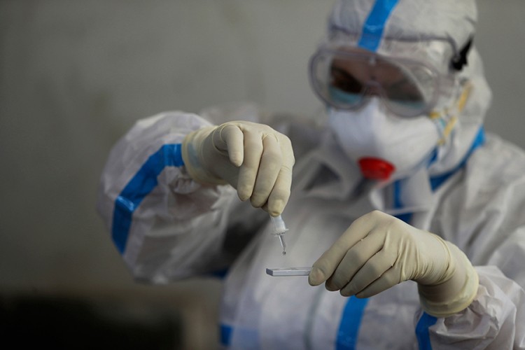 U Sloveniji broj novozaraženih koronom opet veći od 2.000