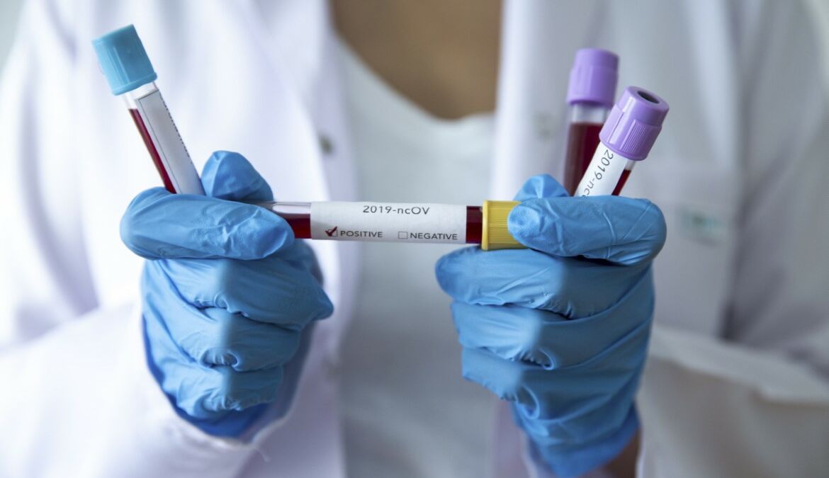 Koronavirus potvrđen kod još 596 osoba, pet preminulih