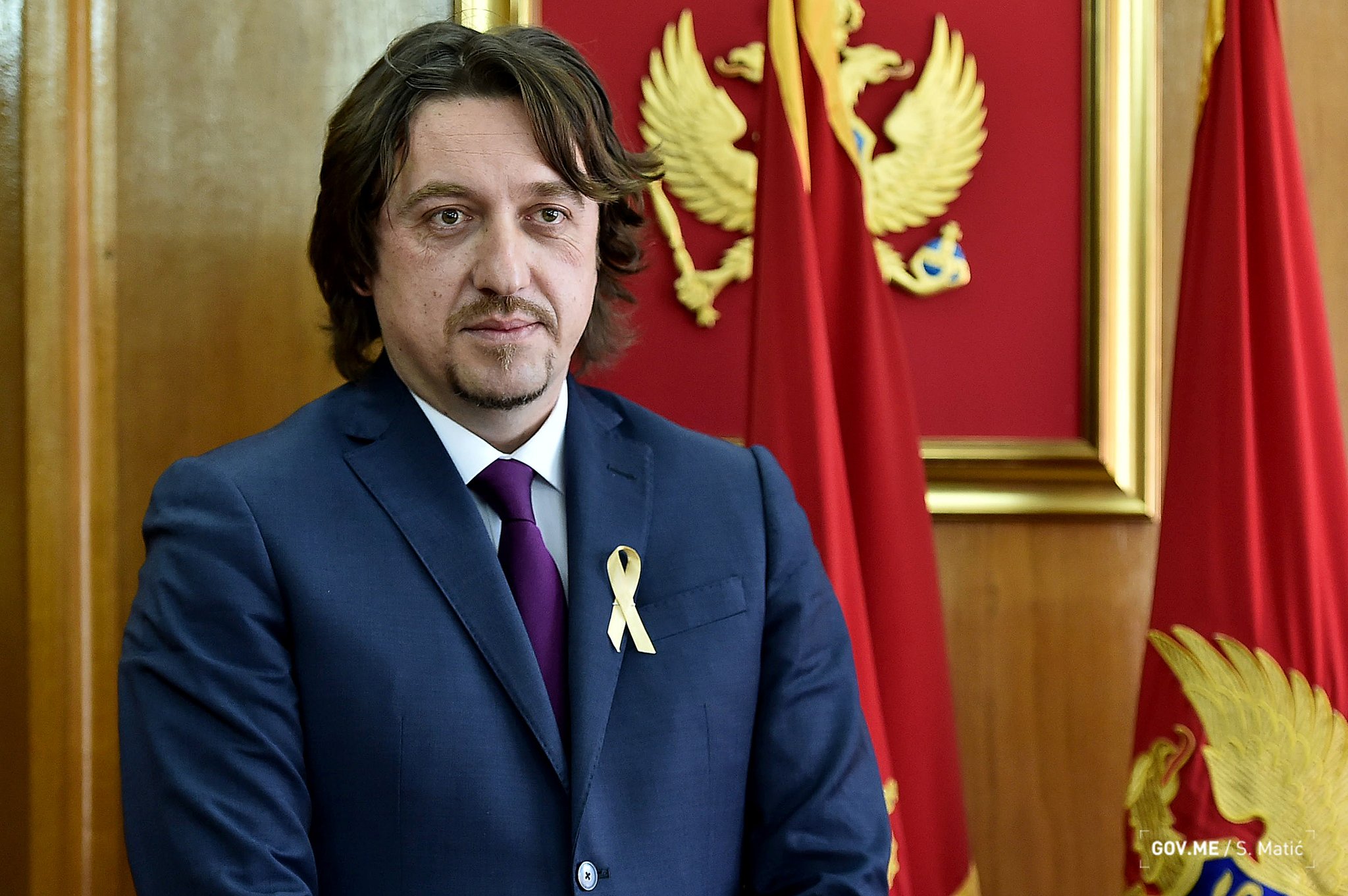 Sekulović se pridružio kampanji NVO Fenix, u znak podrške djeci oboljeloj od malignih bolesti