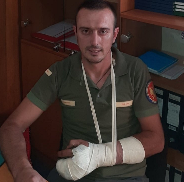 Uprava za šume: Šumaru slomljena šaka, podnijeta prijava